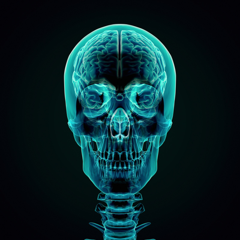 人脑,X光,发型,透明,X光片,侧面像,黑色背景,医学扫描,人的头部