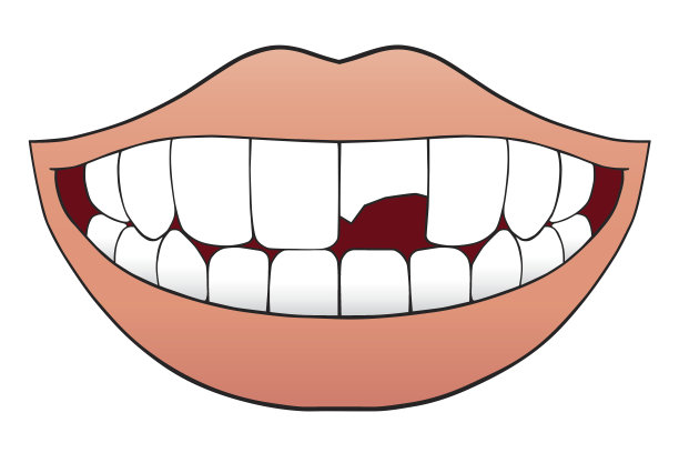 畸形牙齿