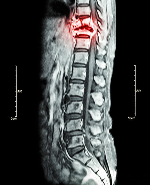 移动ct