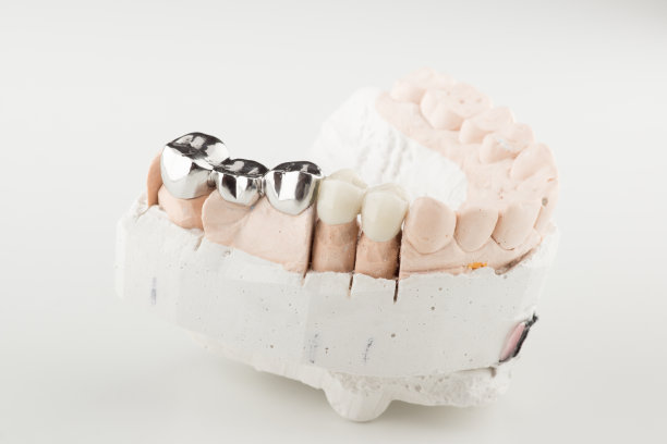 陶瓷牙齿
