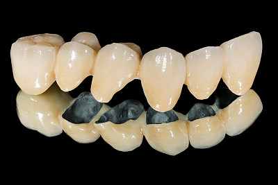 陶瓷牙齿