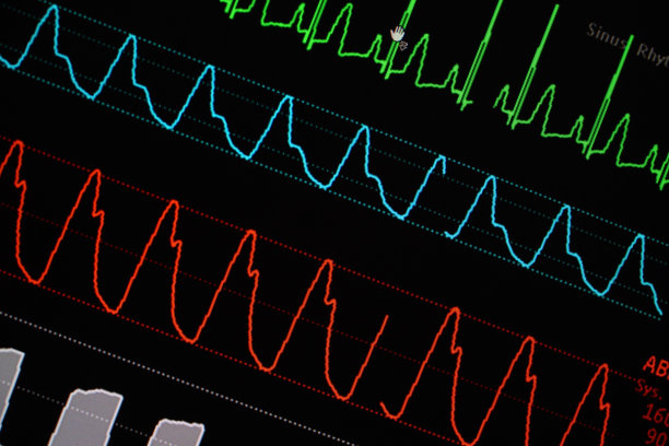 医疗技术科技心电图
