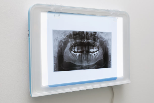 X光,水平画幅,牙痛