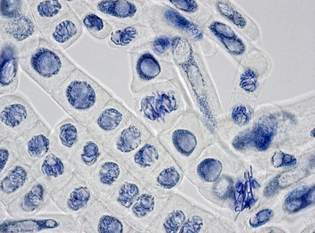 植物细胞,细胞核,玷污的,图像,显微镜,真核细胞,大规模的放大,基因