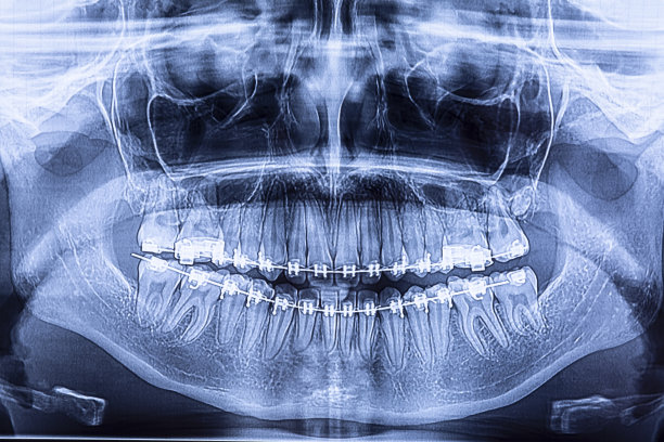 牙科医疗 口腔健康研究