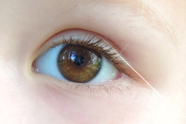 关注儿童 视力健康