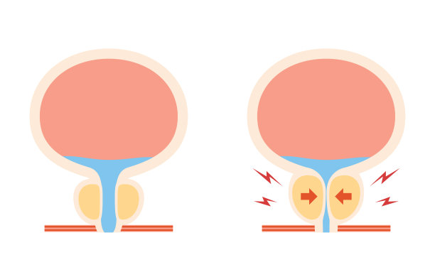 前列腺解剖图