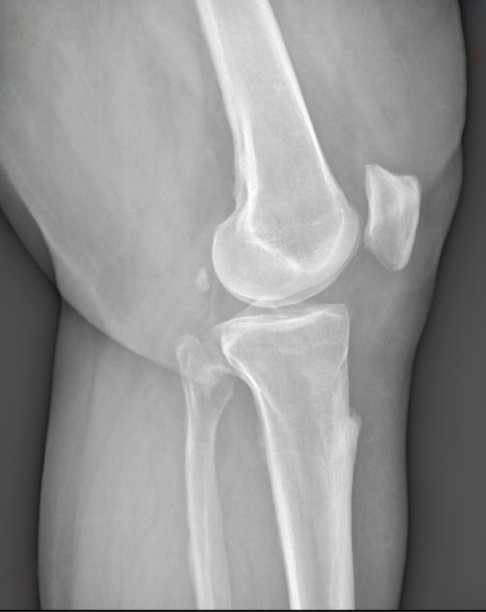 膝关节解剖图