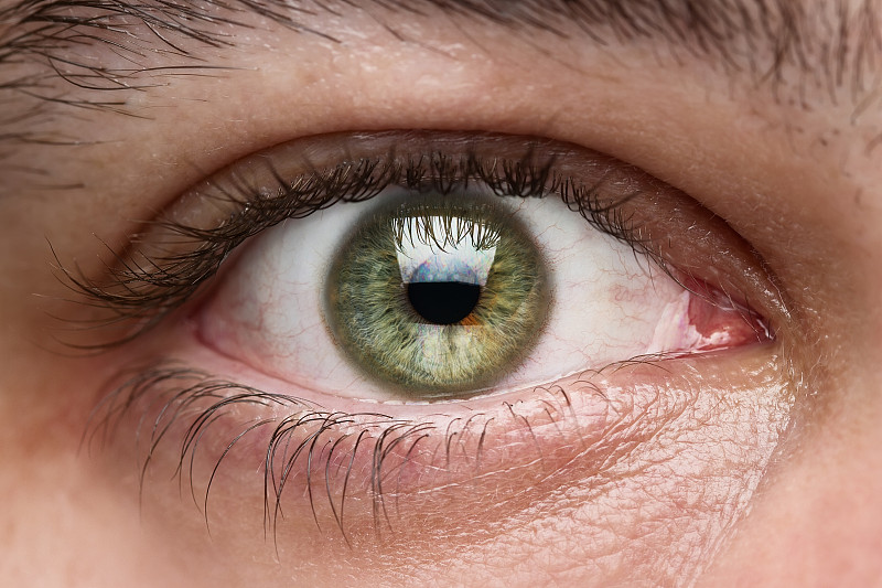 绿色眼睛,特写,一个人,白色,眼痛,角膜,视网膜,验光师,眼睛颜色
