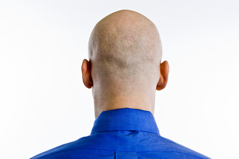 秃头,后脑勺,非全秃,头皮,剃光头,30到39岁,水平画幅,形状,在之后,白人