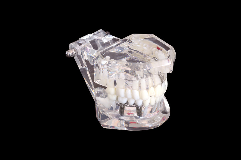 人的嘴,口腔卫生,人的牙齿,分离着色,人,隆胸手术,茂德,牙科模具,替代,解剖模型