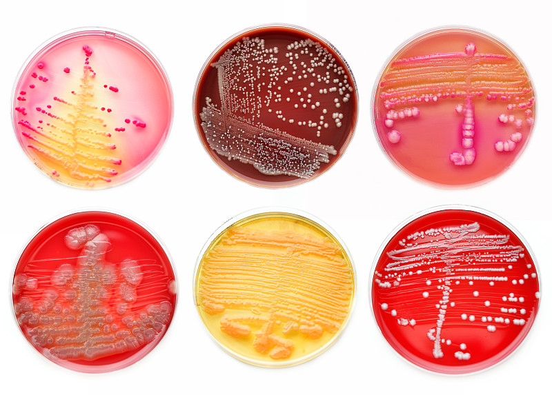 细菌,皮氏培养皿,绿脓杆菌,马康基氏琼脂,双球菌,血琼脂,金黄色葡萄球菌,克雷白杆菌属,大肠杆菌,白喉