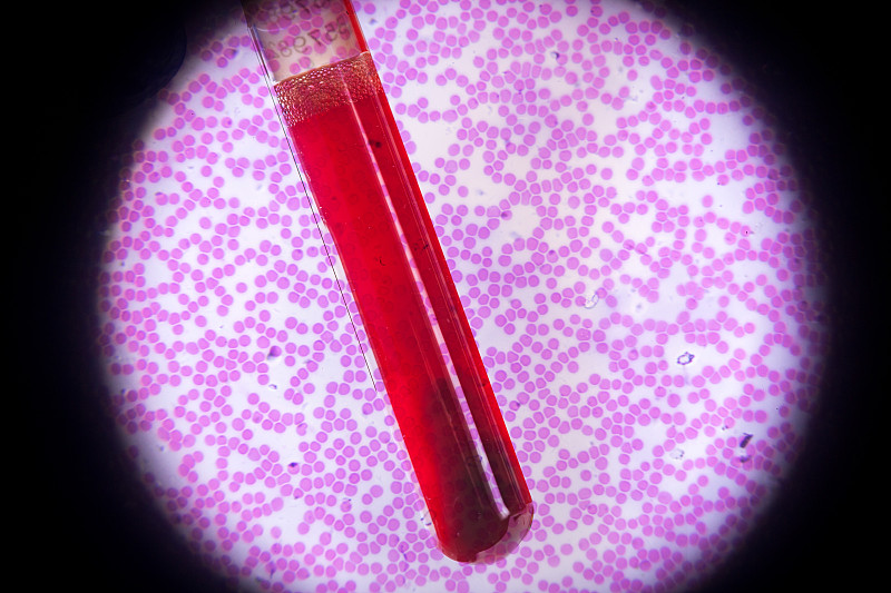 放大效果,人,在下面,免疫学,红细胞,生物医学插图,装管,医学样本,显微镜,试管