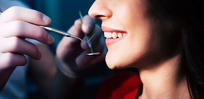 一张由专业牙医在牙科器械的帮助下检查结果一段时间后做出的美丽微笑的照片。