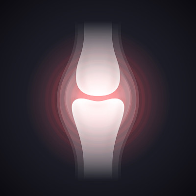 膝关节疼痛或损伤x光片