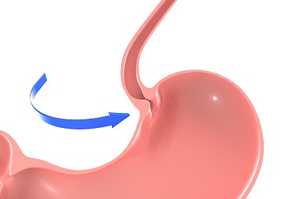 人体胃的3D插图，突出十二指肠括约肌和食道。
