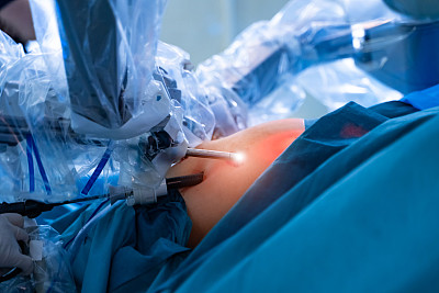 医院的手术室里有机器人技术设备，机器手臂外科医生在未来的手术室里