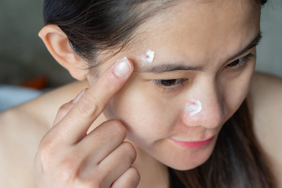 亚洲妇女试图应用痤疮霜在她的脸上痤疮。