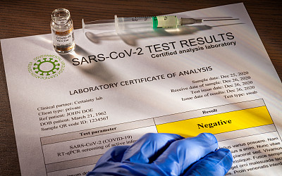 导致COVID-19的SARS-CoV-2冠状病毒检测阴性文件