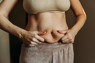 年轻女子怀孕后肚子上满是妊娠纹。