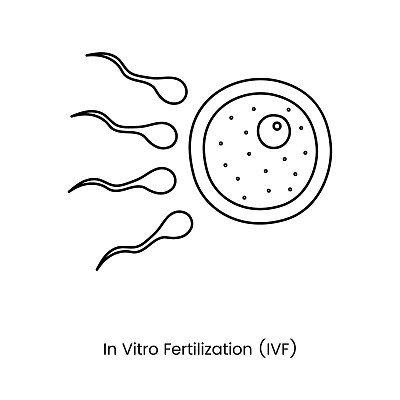 卵子是未受精的，精子是载体人工授精图中的图标线。体外受精，IVF。