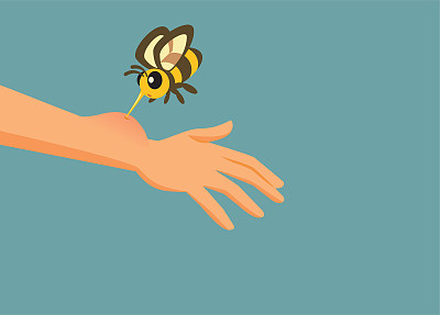 手被蜜蜂蜇有过敏反应载体插图