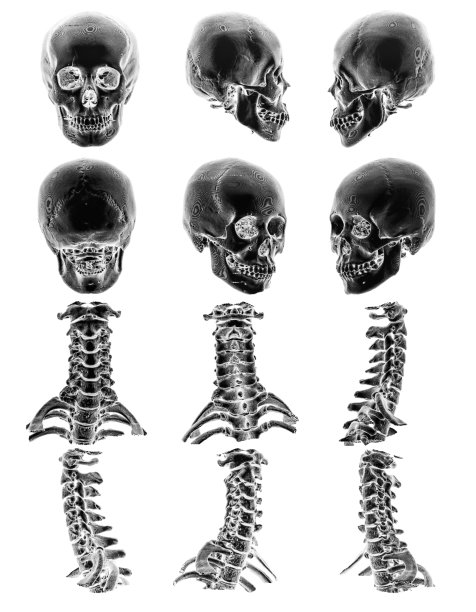 3D扫描