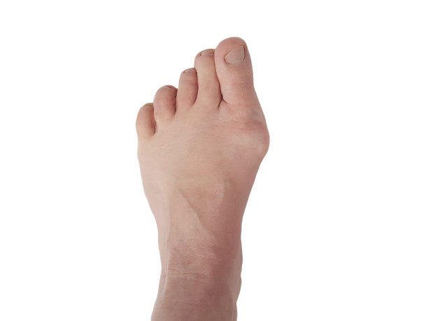 肿胀的