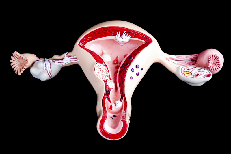 卵巢,黑色背景,宫颈癌,子宫内膜,解剖模型,骨盆腔炎症,有月经,生病