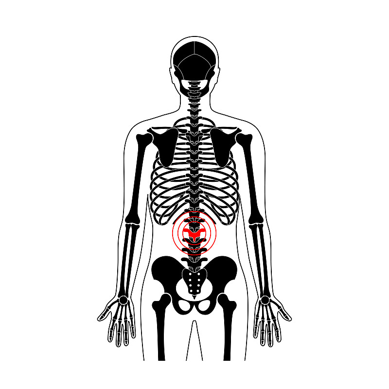 绘画插图,矢量,痛苦,脊柱,健康保健,背景分离,骷髅图,按摩师,脖子,人类骨架