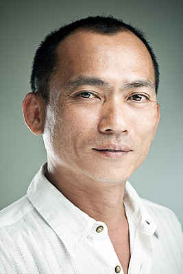 发际线后移