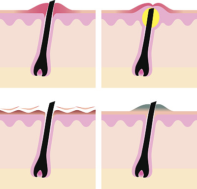 阴毛图片大全 阴毛设计素材 阴毛模板下载 阴毛图库 昵图网soso Nipic Com