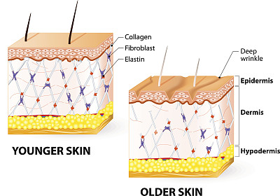 皮肤老化