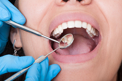 牙医的工具和张开的嘴和美丽的牙齿