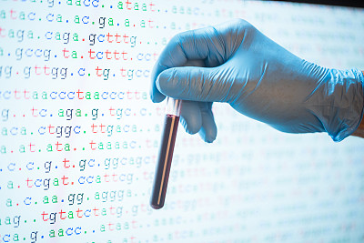戴着手套的研究人员拿着屏幕上有颜色编码DNA序列的血样