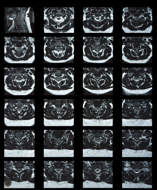 mri