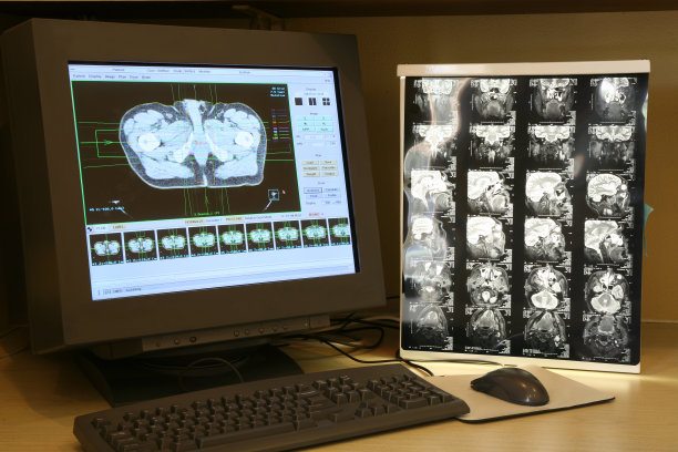 mri