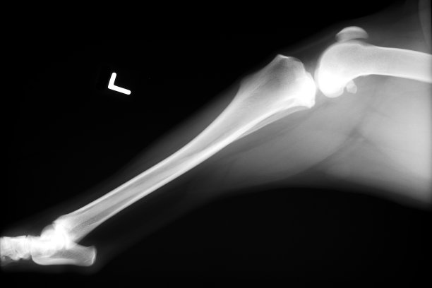 X光,股骨,水平画幅