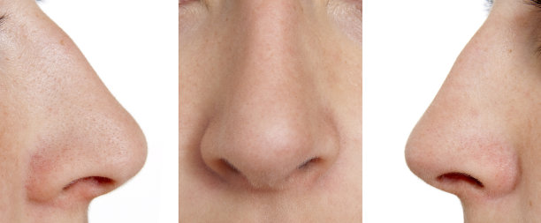 nose