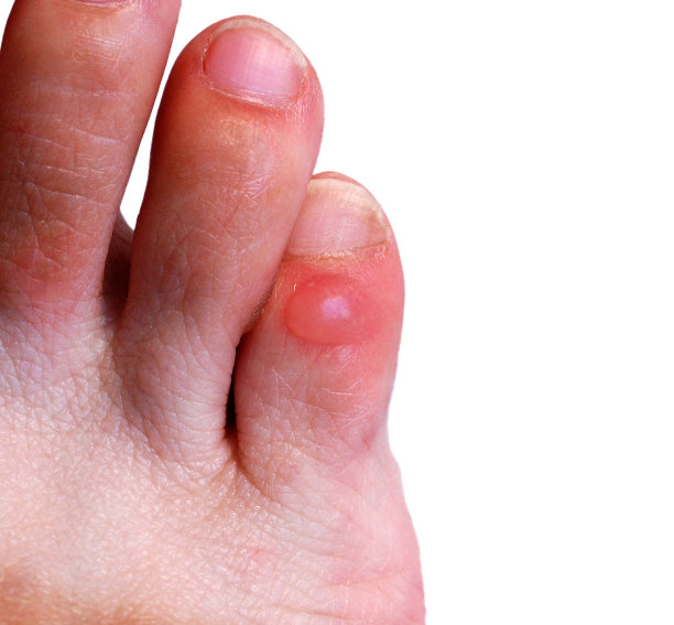 feet