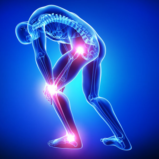 arthritis