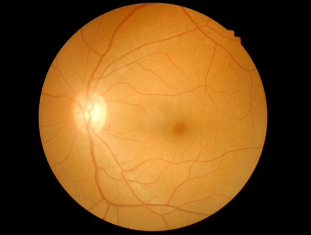 retina