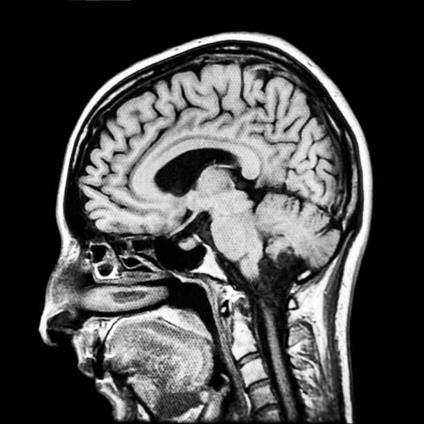 mri