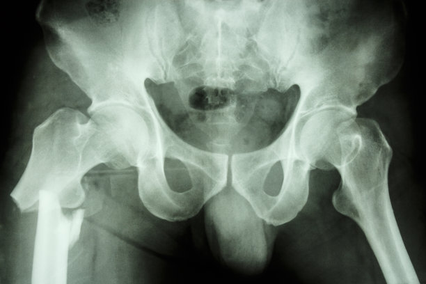 pelvis