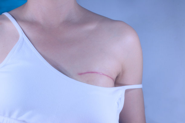 breast