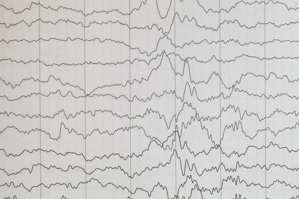 eeg