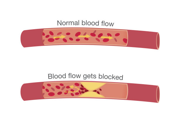 cholesterol