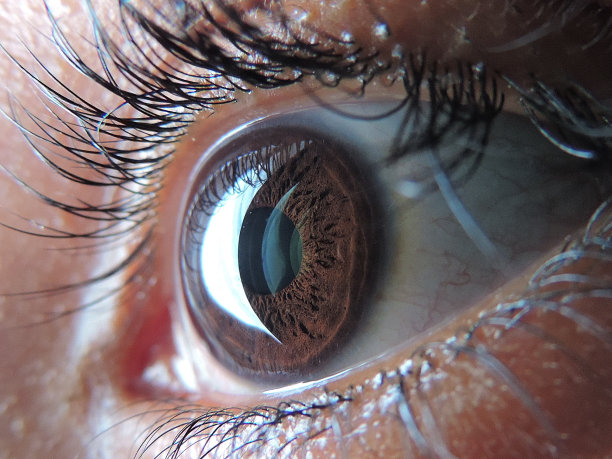 retina