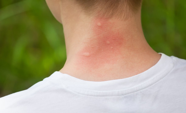 mosquito