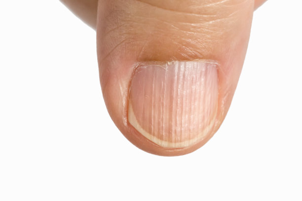 nail